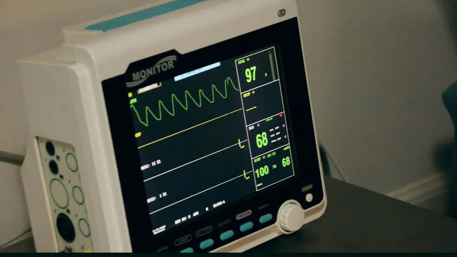 A cardiac monitor showing heart rhythm and vital signs
